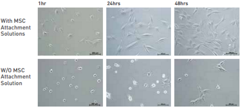 mesenchymal stem cells were cultured in MSC NutriStem® XF with and without MSC Attachment Solution