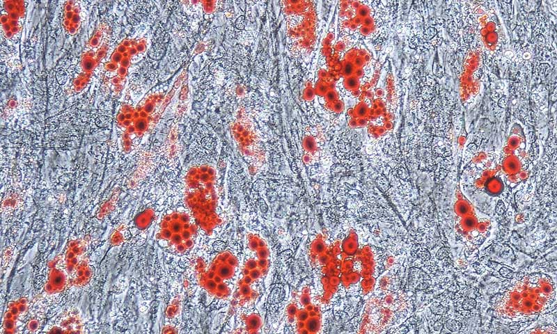 Adipogenic Differentiation