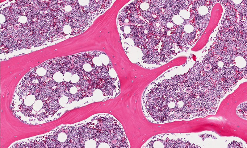 Amniotic Fluid & Chorionic Villus Cells