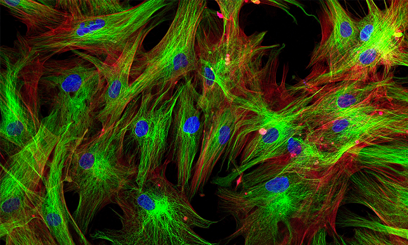 Stem Cell Differentiation