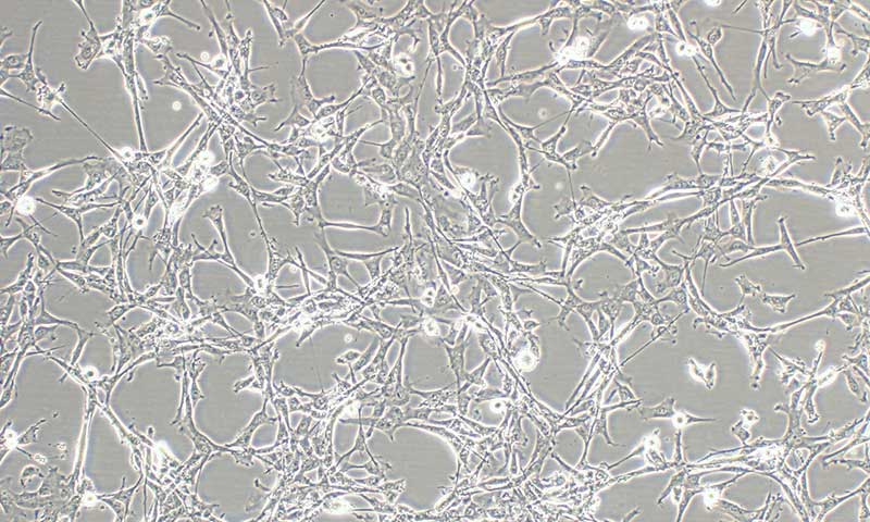 Human Mesenchymal Stem Cells