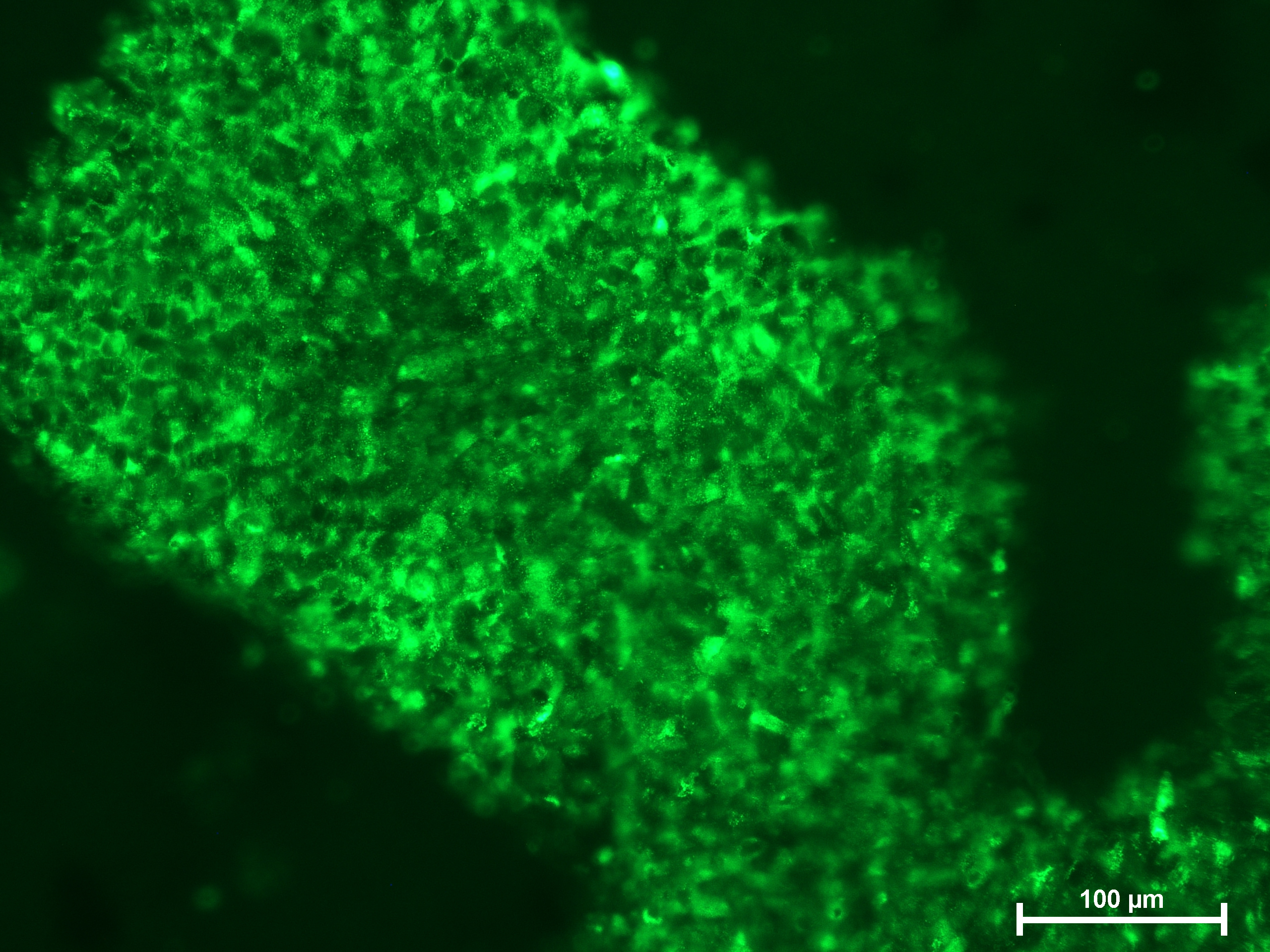 Immunofluorescence analysis of hESC cultured in NutriStem V9 - green stained