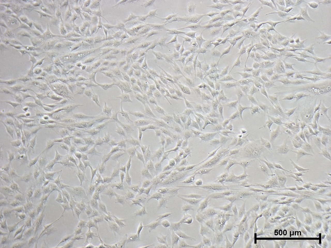 mesenchymal stem cells