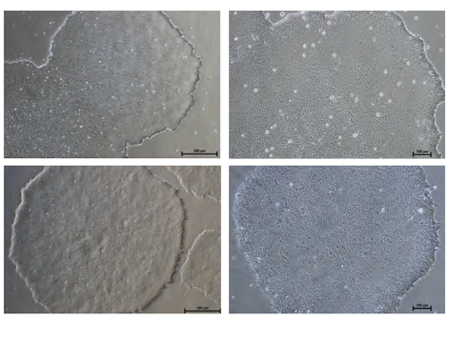 hiPS & hESC Normal Colony Morphology on NutriStem medium.